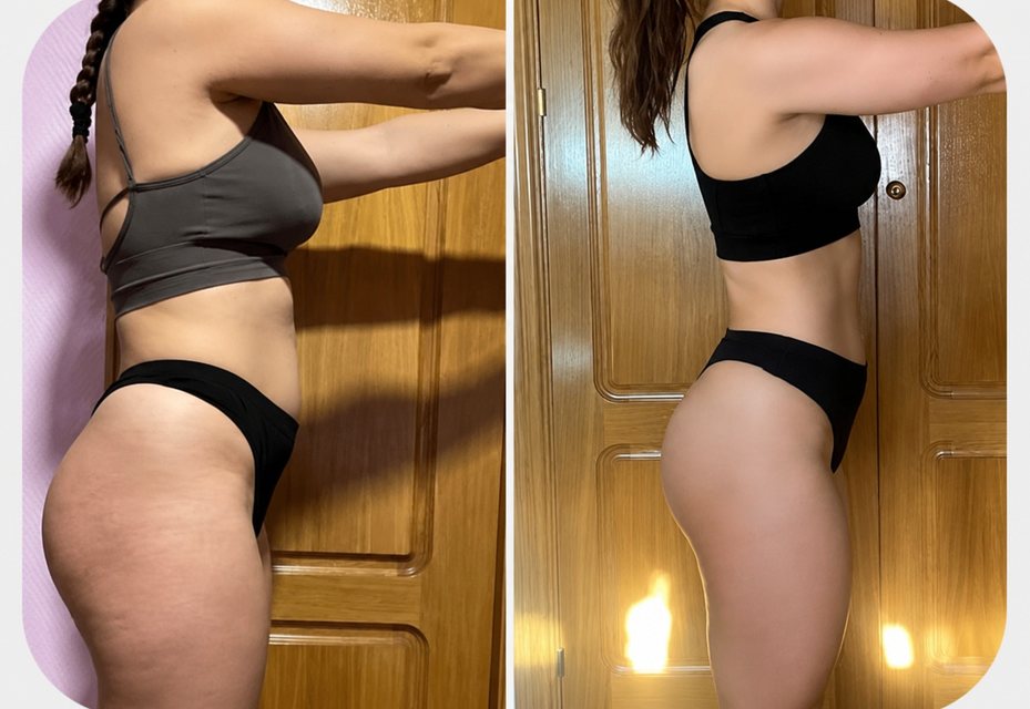 Antes y después de una clienta de Nahum Melgar