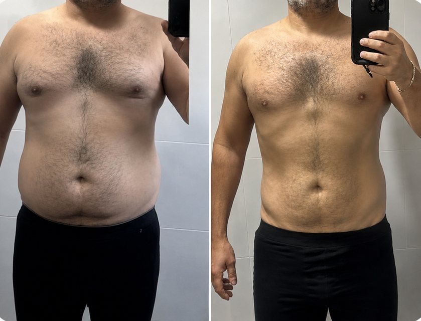 Antes y después de un cliente de Nahum Melgar